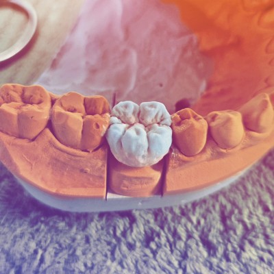 Tehnician Dentar Metalist Specialist